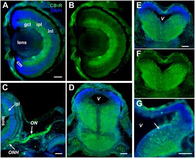 Cell-autonomous and differential endocannabinoid signaling impacts the development of presynaptic retinal ganglion cell axon connectivity in vivo